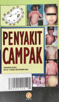 Image of Penyakit Campak