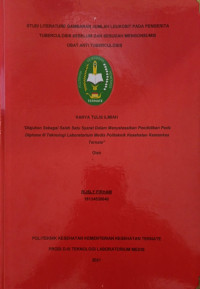 Image of Studi Literature Gambaran Jumlah Leukosit Pada Penderita Tuberkulosis Sebelum Dan Sesudah Mengonsumsi Obat Anti Tubekulosis